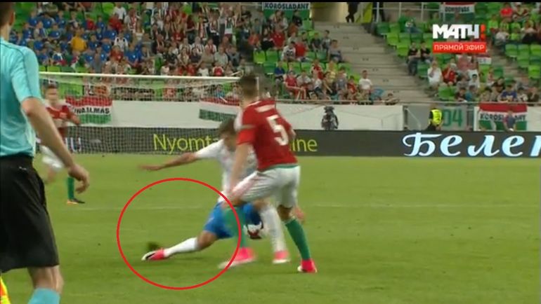 Эпизод с травмой Романа Зобнина. Эпизод с травмой Романа Зобнина.