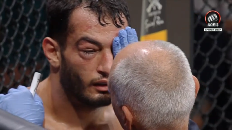 Уже после первого раунда врач вышел осмотреть глаз голландца.