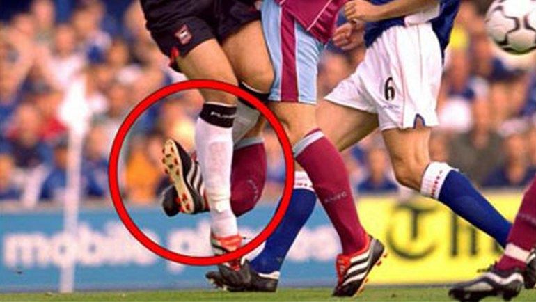 Травма Люка НИЛИСА. Фото ybig.ie Травма Люка НИЛИСА. Фото ybig.ie