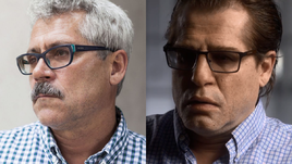 Григорий РОДЧЕНКОВ в Америке: до и после пластической операции.