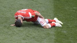 Четверг. Москва. Лужники. Россия - Саудовская Аравия. Травмированный Алан ДЗАГОЕВ.