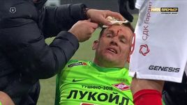 Артем Ребров после столкнокения.