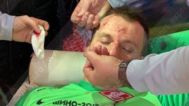 Артем Ребров после матча с "Локо".