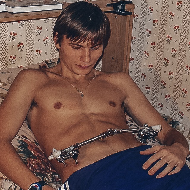 Стержневой аппарат, с которым Илье Трифанову пришлось провести два месяца. Фото Личный архив Ильи Трифанова Стержневой аппарат, с которым Илье Трифанову пришлось провести два месяца. Фото Личный архив Ильи Трифанова