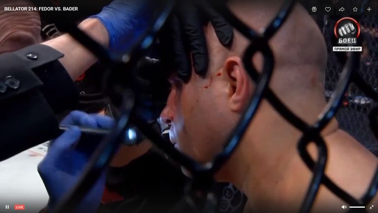 Бой Емельяненко - Бейдер. Бой Емельяненко - Бейдер.