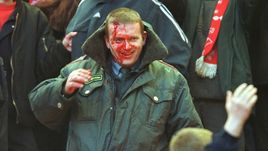 31 марта 2001 года. Москва. "Спартак" - ЦСКА - 1:0. Во время игры травмы получили фанаты и сотрудники милиции.