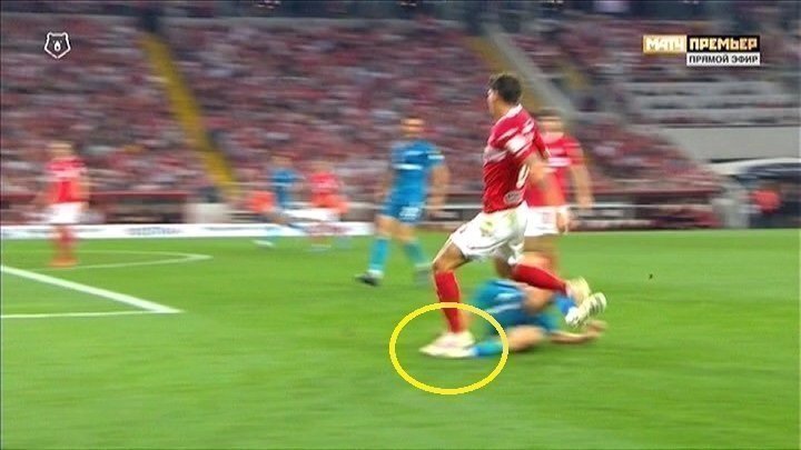 Аяз Гулиев шипами наступил Игорю Смольникову на голеностоп. Аяз Гулиев шипами наступил Игорю Смольникову на голеностоп.