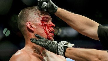 2 ноября. Нью-Йорк. Нейт Диас.