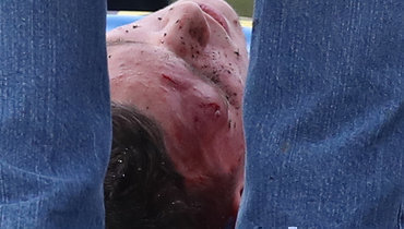 8 ноября. Москва. «Спартак» — «Крылья Советов» — 4:2. Травма Александра Босова.