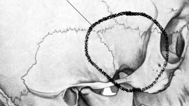 Височная область, в которую попал Федор. Височная область, в которую попал Федор.