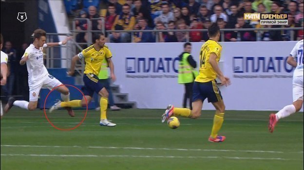 Удаление Карпова. Удаление Карпова.