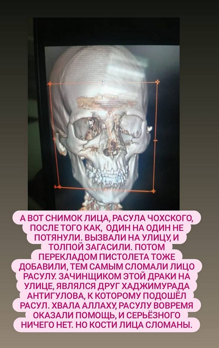 Сторис Instagram. Фото Instagram Сторис Instagram. Фото Instagram