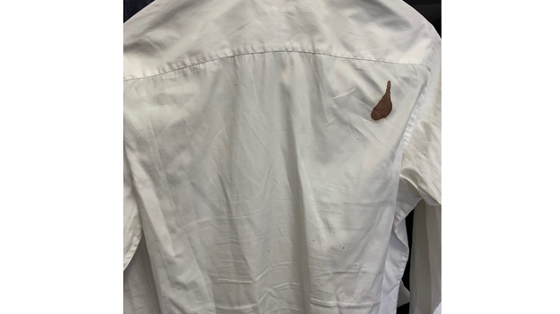 Кровь на рубашке. Кровь на рубашке.