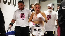 «Теперь у меня глаз больше, чем сиськи!» Секс-символ бокса проиграла из-за жуткой гематомы