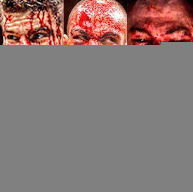 Лица соперников Тони Фергюсона. Лица соперников Тони Фергюсона.