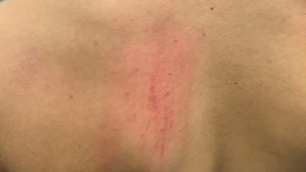 Димитри Пайет и его спина. Фото Twitter Димитри Пайет и его спина. Фото Twitter