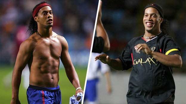 До и после: Роналдинью. До и после: Роналдинью.