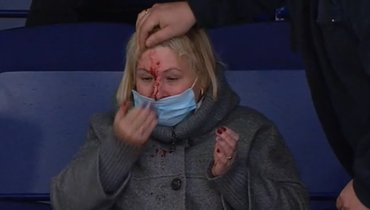 Пострадавшая болельщица на трибунах в Казани.