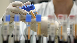 Американка и немка изобрели допинг будущего и получили Нобелевскую премию. «Генетические ножницы» изменят мировой спорт