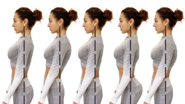 Виды нарушения осанки. Фото Tgchannels Виды нарушения осанки. Фото Tgchannels