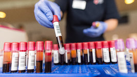 Калий: причины и симптомы дефицита и его роль в организме