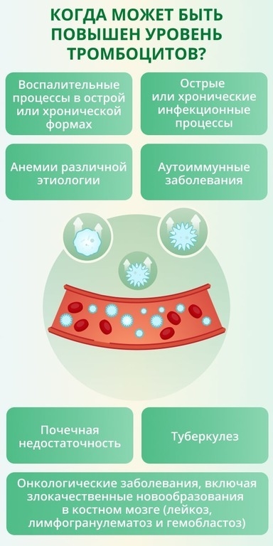 Причины повышенных тромбоцитов. Фото Комсомольская правда Причины повышенных тромбоцитов. Фото Комсомольская правда