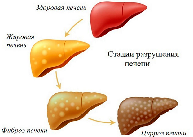 Болезни печени. Фото uviks.ru Болезни печени. Фото uviks.ru