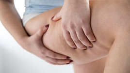 5 способов борьбы с целлюлитом в домашних условиях