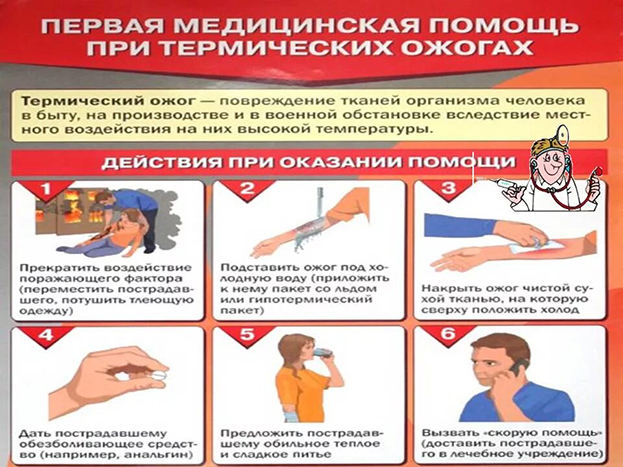 Первая помощь при термических ожогах. Первая помощь при термических ожогах.