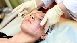 5 продуктов, которые портят кожу