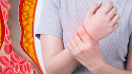 Как определить уровень холестерина по анализу крови? Советы врача