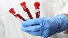 Как определить онкологию на ранней стадии? Советы экспертов