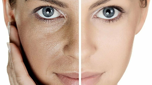 Землистый цвет кожи. Землистый цвет кожи.