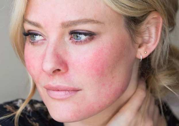 Красный цвет кожи. Красный цвет кожи.