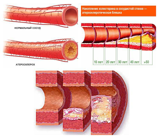 Как холестерин влияет на потенцию. Как холестерин влияет на потенцию.