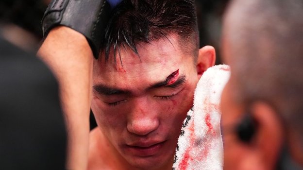 Сечка у Ядонга, которая привела к докторской остановке боя. Фото Chris Unger/Zuffa LLC Сечка у Ядонга, которая привела к докторской остановке боя. Фото Chris Unger/Zuffa LLC