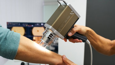 Изучение родинки.