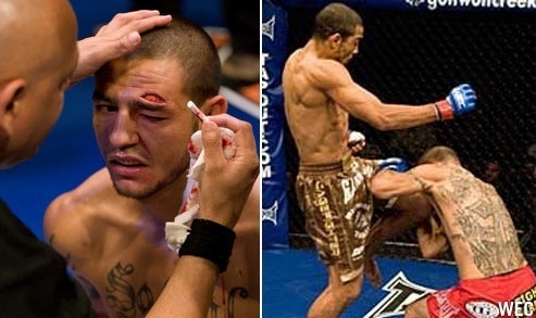 (Каб Суонсон после летящего колена Жозе Альдо. Фото Cкрин из трансляции (Каб Суонсон после летящего колена Жозе Альдо. Фото Cкрин из трансляции