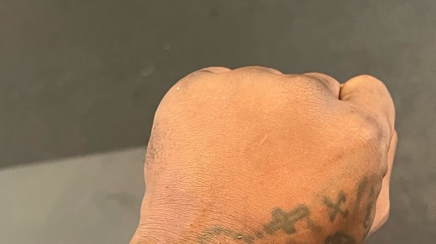 Рука Джермелла Чарло. Фото Соцсети Рука Джермелла Чарло. Фото Соцсети