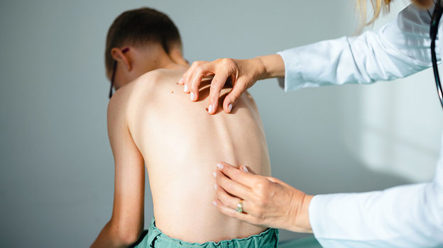 Сколиоз. Фото istockphoto.com Сколиоз. Фото istockphoto.com