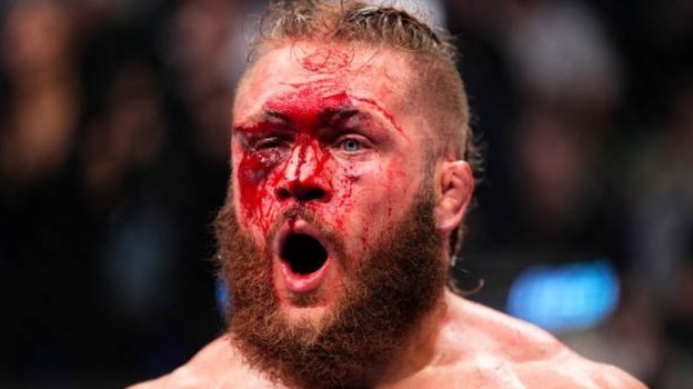 Физиев после боя с Гэтжи.