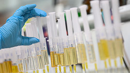 Рука врача проверяет шприцы с образцами спортсменов.