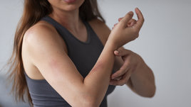 Девушка с садинами на руках