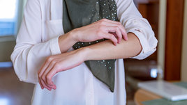 Девушка чешет место укуса комара.