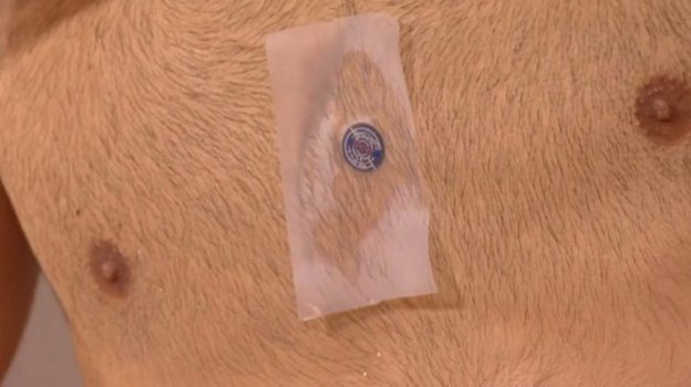 Предмет на груди Джоковича.