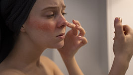 Девушка с покраснениями на лице смотрится в зеркало.