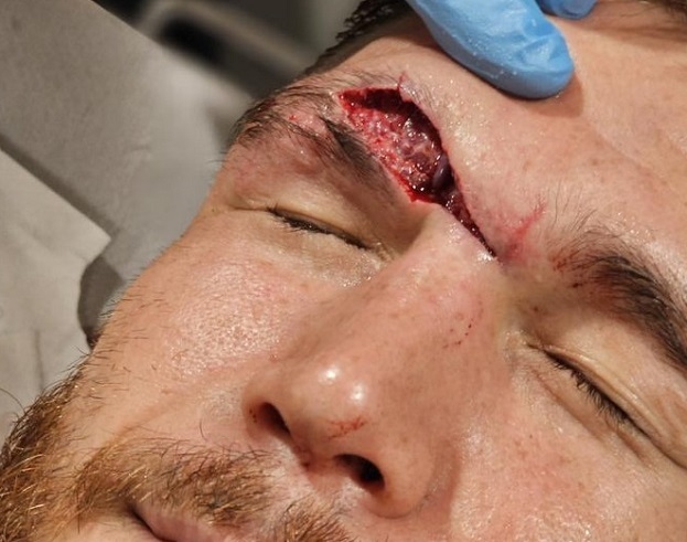 Джонни Эблин.