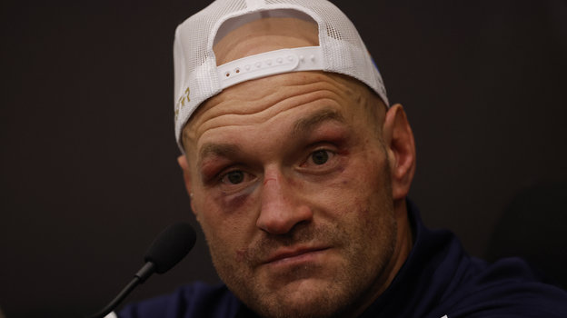 Тайсон Фьюри.