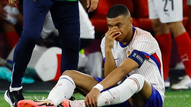 Килиан Мбаппе получил травму носа в матче Австрия - Франция.