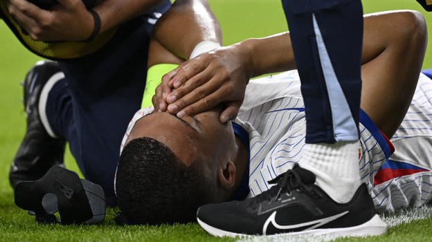 Килиан Мбаппе после попадания мяча в голову.